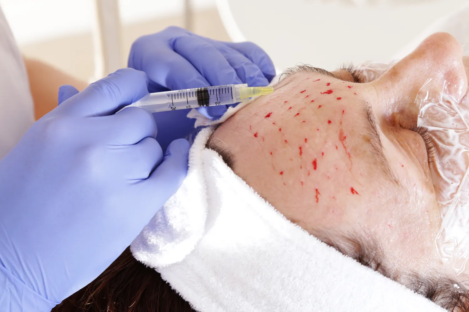 Gdzie kupić kwas hialuronowy?