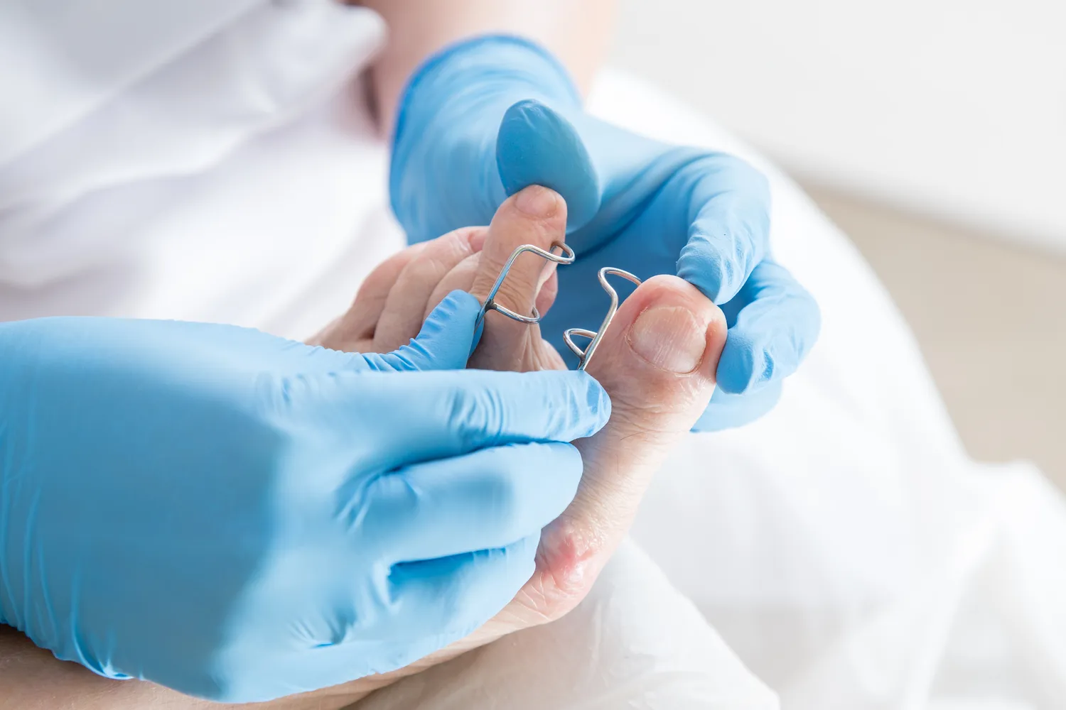 Pedicure leczniczy Szczecin