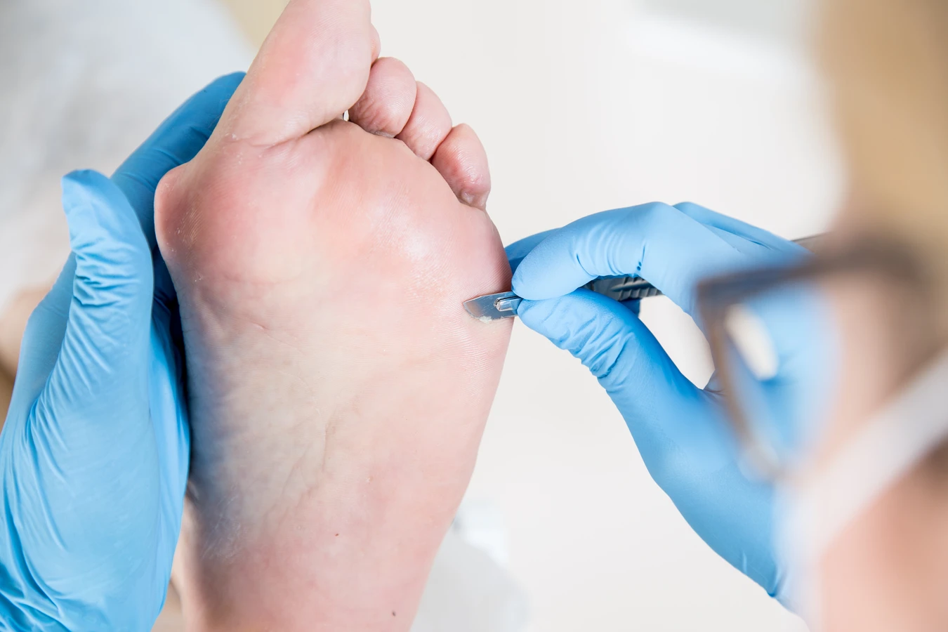 Kiedy należy udać się do gabinetu podologicznego?